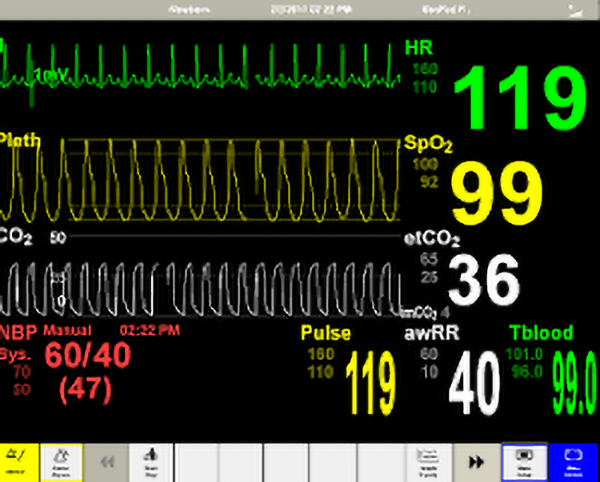 patient monitor